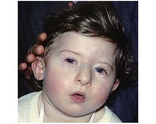 保山公立医院供卵试管婴儿～39岁的她尝试“体内