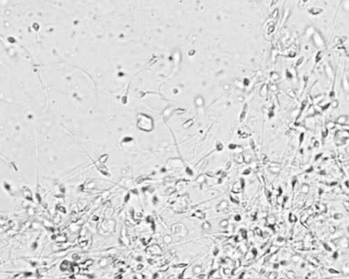 供卵的孩子是亲生的吗_代怀那些比较好