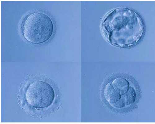 深圳供卵自怀-深圳现在还有代孕-深圳那家做代孕
