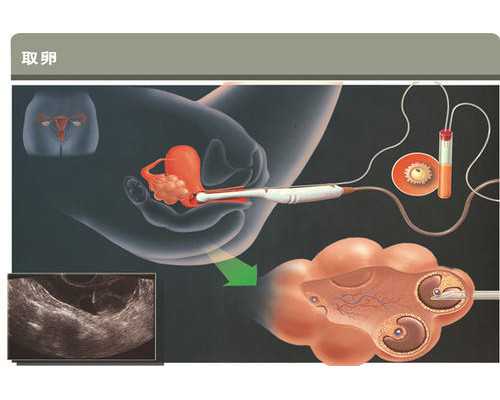 深圳代孕母亲-深圳代孕大概要多少钱-深圳代孕妈妈哪里找
