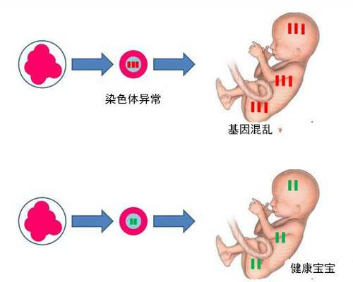 深圳代孕妈妈_深圳谁想找代孕_深圳最便宜的代孕机构