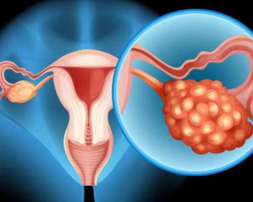 深圳代孕多少钱-深圳代孕选性别-深圳代孕中介靠谱吗