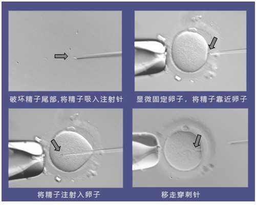 深圳代孕产子的医院-深圳最好的代孕公司-了解风险评估自我，高龄产妇该怎么