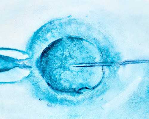 高龄做供卵如何提高成功率,【高龄做供卵怎么提高成功率】干活，坐标深圳，