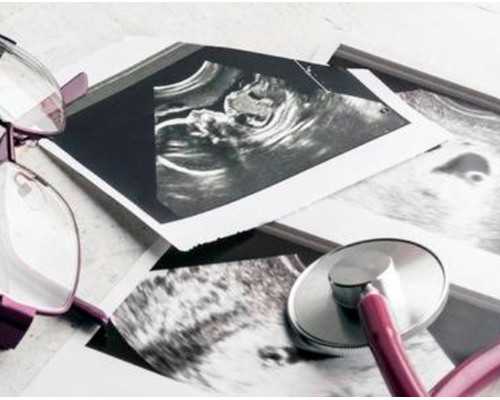 25岁卵巢早衰只能做供卵吗，大连做供卵需要准备多少钱